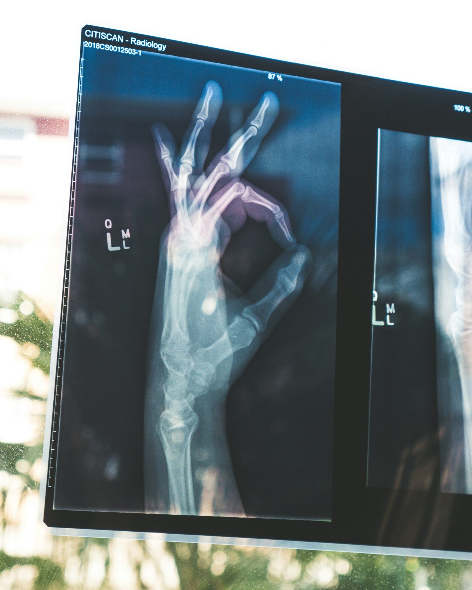 L’IA Majeure dans le Diagnostic Médical : De l’Apprentissage Profond à l’IA Générative